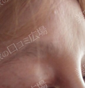 治療結果の症例写真