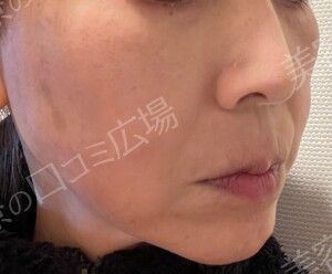 治療結果の症例写真