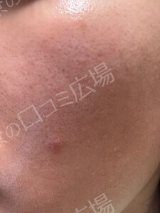 治療前の症例写真