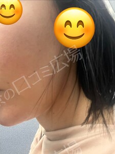 治療前の症例写真