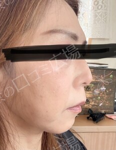 治療結果の症例写真
