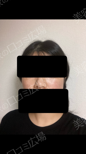 さっぽろ美容クリニック 本院の症例写真[アフター]