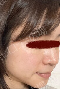 治療前の症例写真