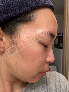 治療前の症例写真