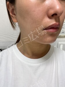 治療結果の症例写真