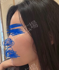 治療結果の症例写真