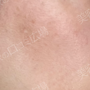 治療前の症例写真