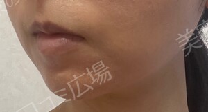 治療前の症例写真