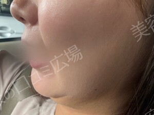 治療前の症例写真