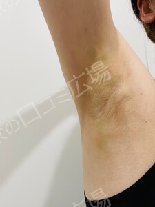 治療結果の症例写真