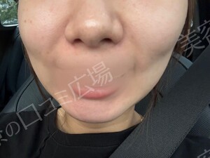 治療結果の症例写真