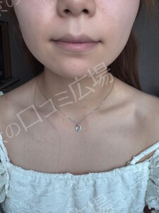 治療結果の症例写真