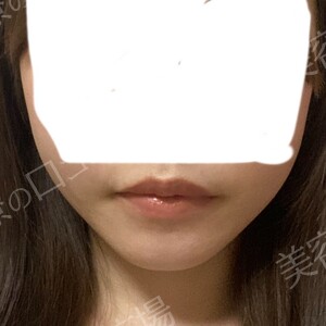 治療前の症例写真