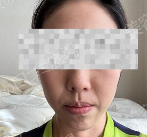 治療結果の症例写真