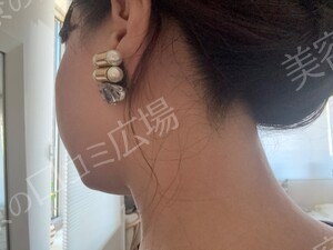 治療結果の症例写真