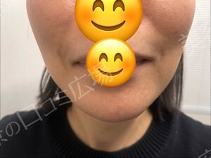 治療前の症例写真