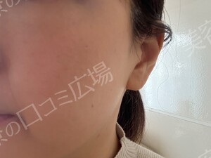 治療結果の症例写真