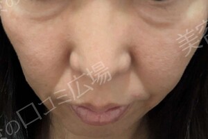 治療前の症例写真