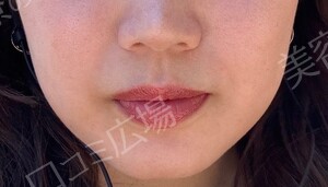 治療前の症例写真