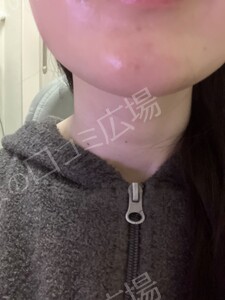 治療結果の症例写真