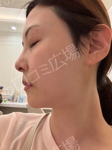 治療前の症例写真