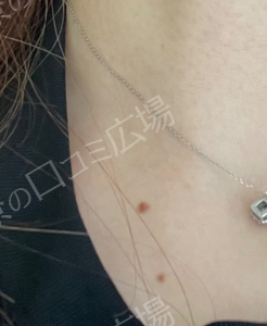 治療前の症例写真