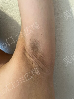 THE CLINIC NAGOYA 【ザ・クリニック名古屋】の症例写真[アフター]