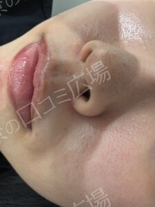 治療結果の症例写真