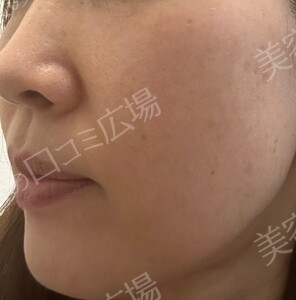 治療前の症例写真