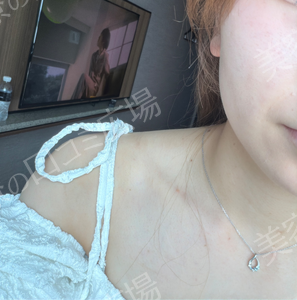 治療結果の症例写真