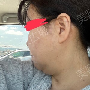 治療前の症例写真