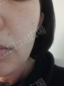治療結果の症例写真