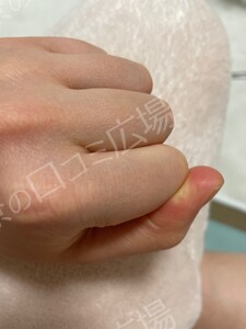 治療結果の症例写真