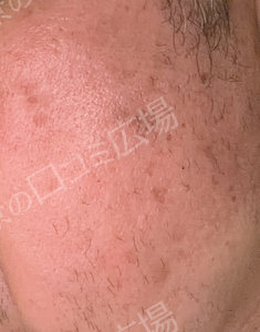 治療結果の症例写真