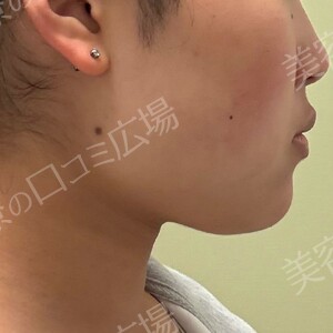 治療前の症例写真