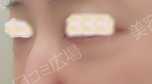治療前の症例写真