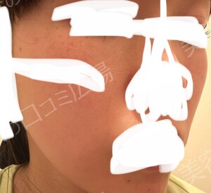 治療結果の症例写真