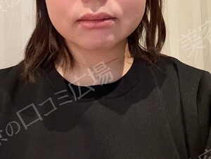 治療結果の症例写真