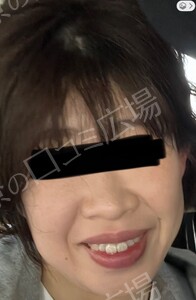 治療前の症例写真