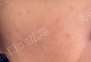 治療結果の症例写真
