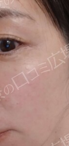 治療結果の症例写真