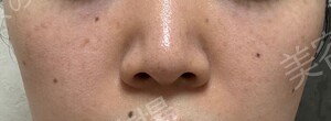 治療前の症例写真