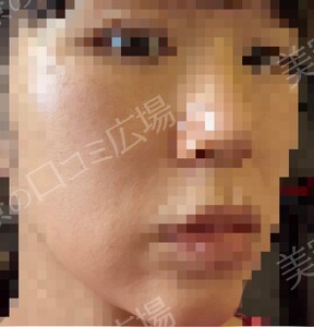 治療結果の症例写真