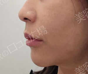 治療前の症例写真