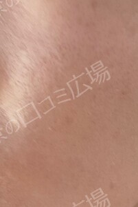 治療結果の症例写真