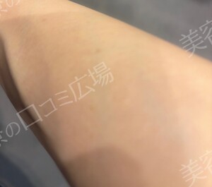 治療前の症例写真