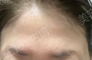 治療結果の症例写真