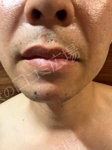 治療前の症例写真