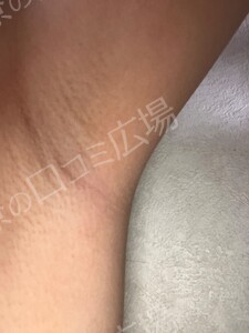 治療前の症例写真