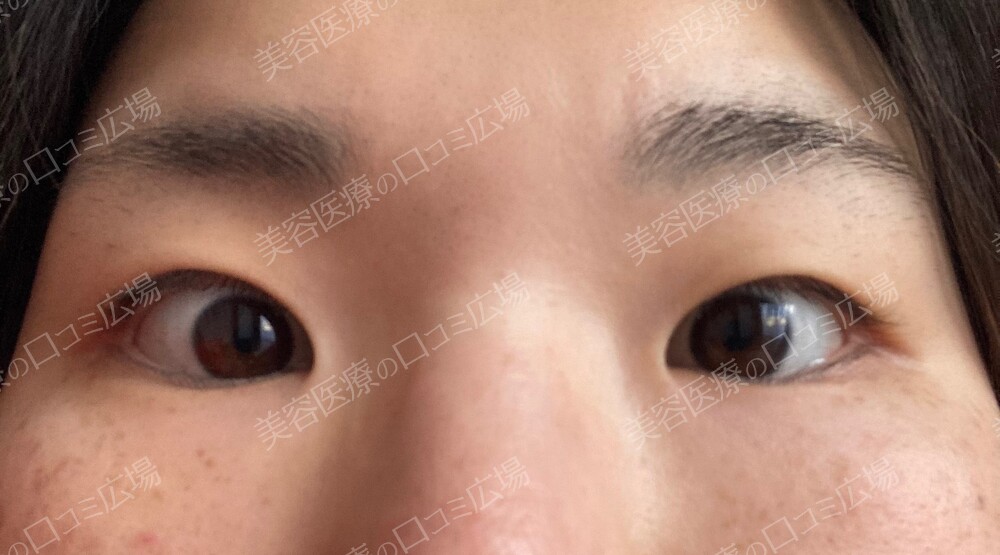 緊急トラタミエント